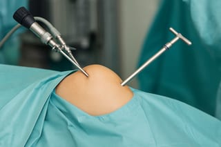 Arthroskopien aller Gelenke